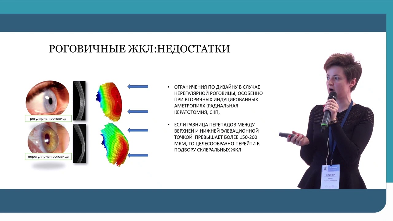 Аверич В.В.- Роговичные или склеральные газопроницаемые линзы – что лучше? Преимущества и недостатки