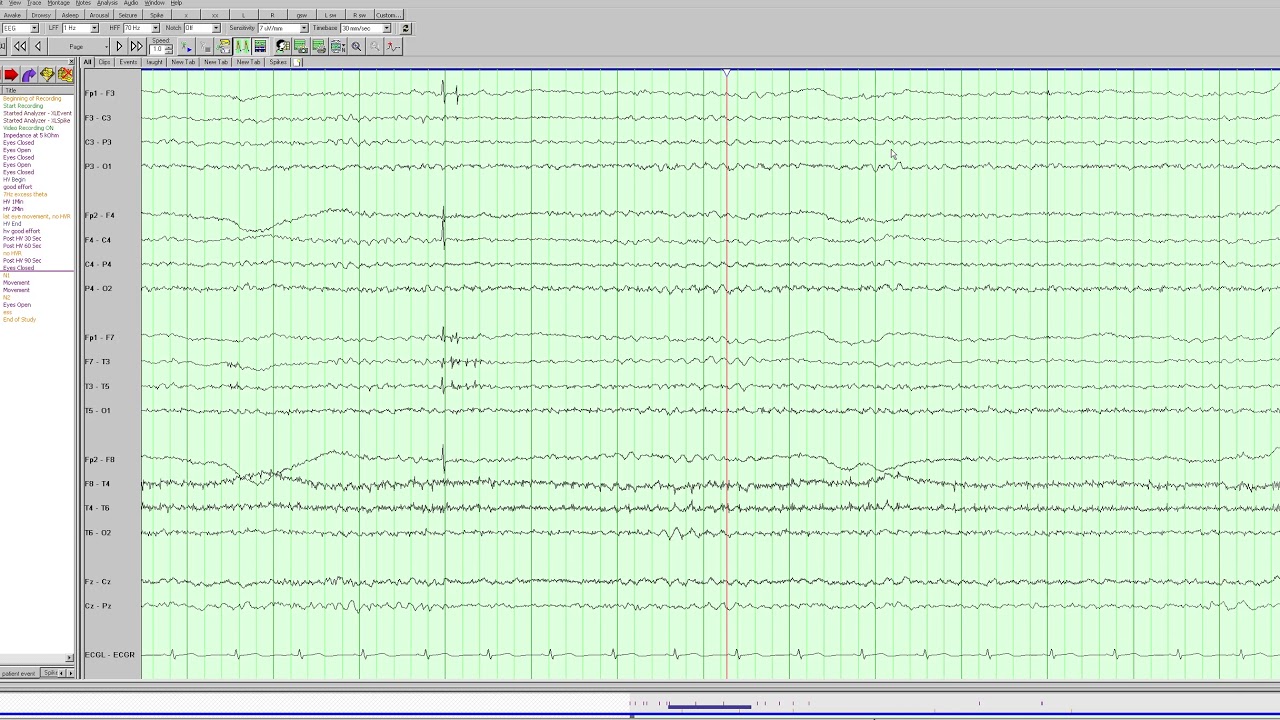 Diffuse slowing