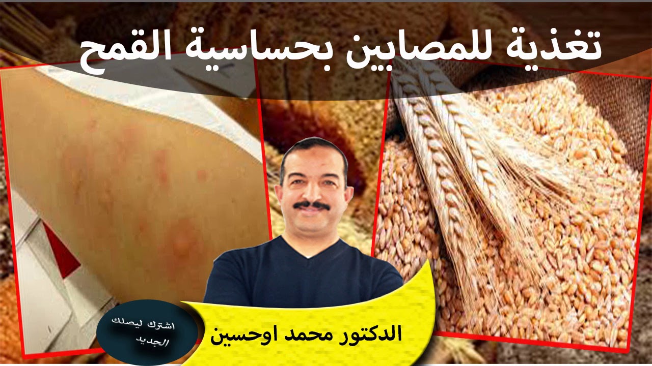 تغذية للمصابين بحساسية القمح او الجلوتين او السيلياك الدكتور محمد اوحسين