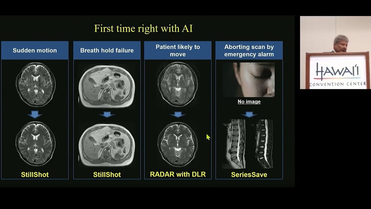 ISMRM 2025 First Time Right MRI Symposium w Fujifilm and Dr. Tanenbaum