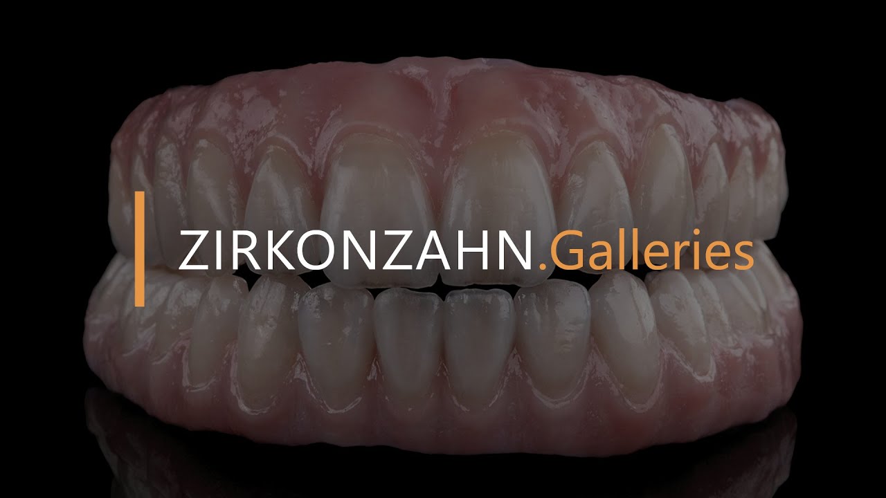 Digitaler Workflow: implantatgetragene Komplettversorgung aus Prettau® 2 | Zirkonzahn.Galleries