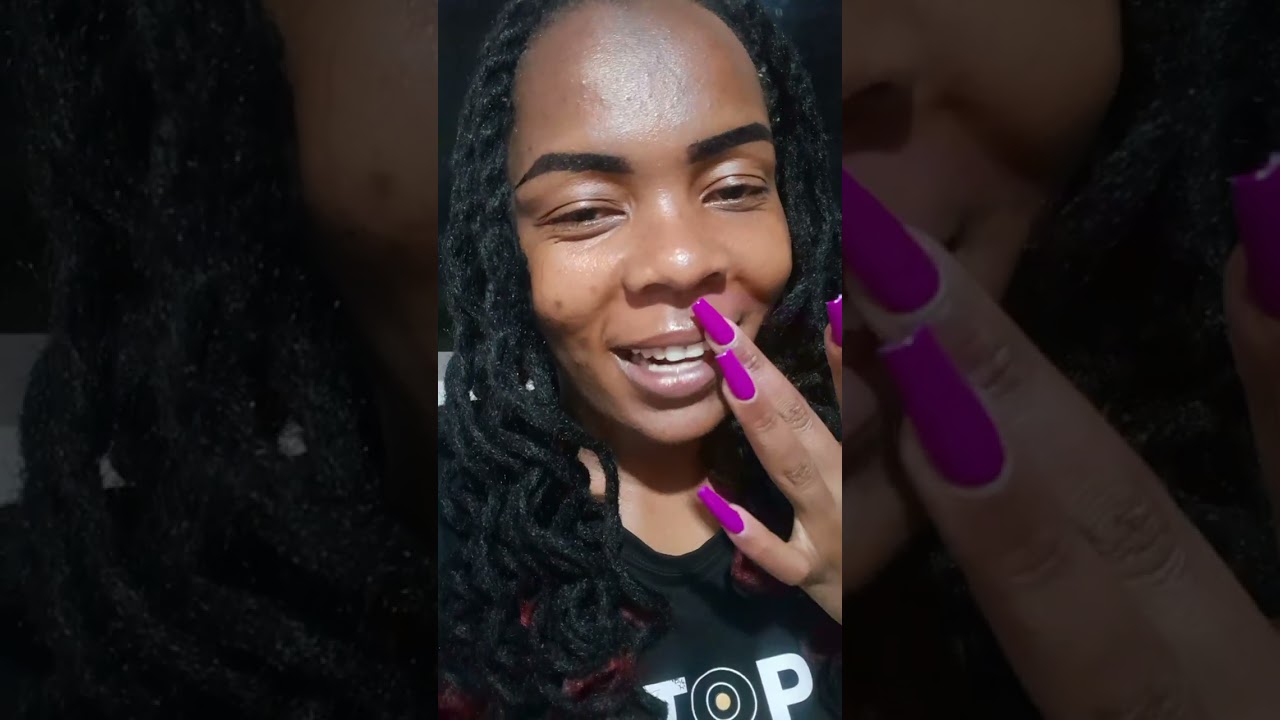 Niambieni Dawa Ya Acne Please 😔😔