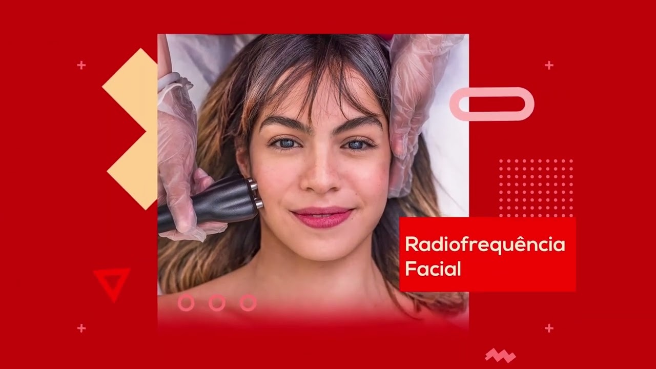 FIOLASER TV HORIZONTAL - FEVEREIRO 2023