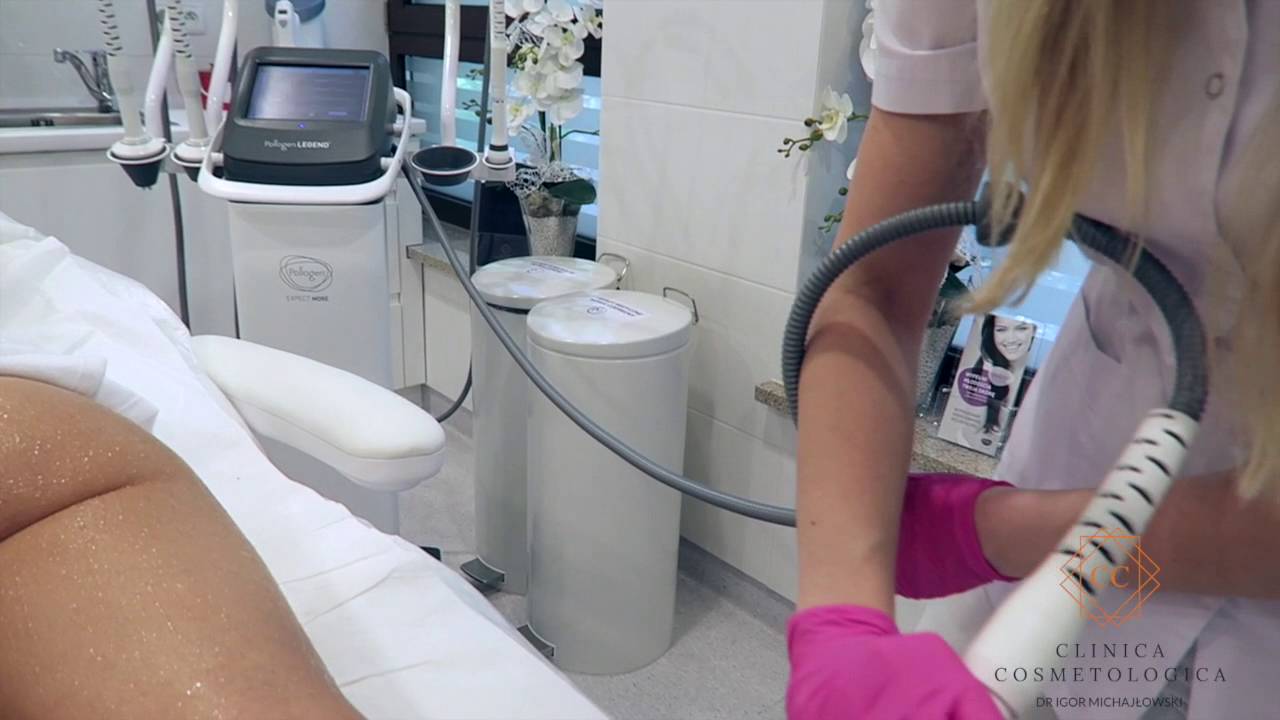 MAXIMUS ➜ ZABIEG NA ŁYDKI. Clinica Cosmetologica dr Igor Michajłowski