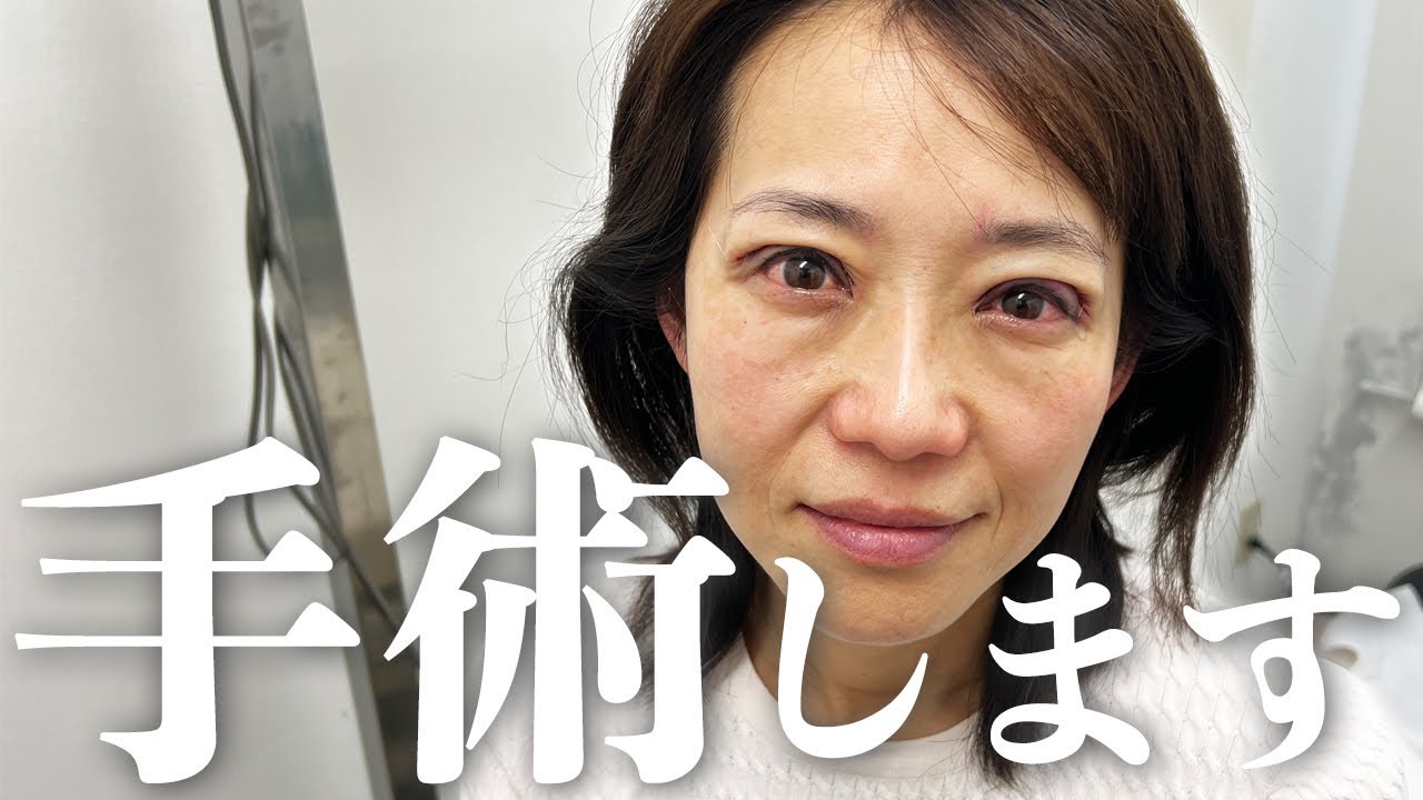 【140万再生‼️同じ悩みを抱えてる人へ】眼瞼下垂で2年以上悩み続け遂に決心！
