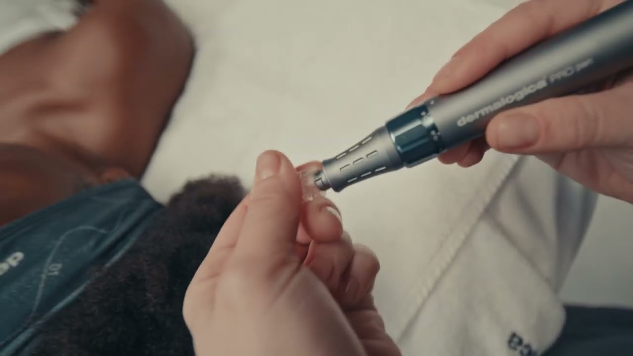 luminfusion: supercharges skin smoothness and luminosity with no downtime