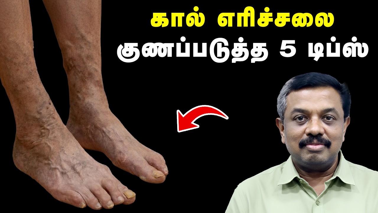 கால் எரிச்சலை குணப்படுத்தும் 5 உணவுகள் ! Diabetes tips in Tamil