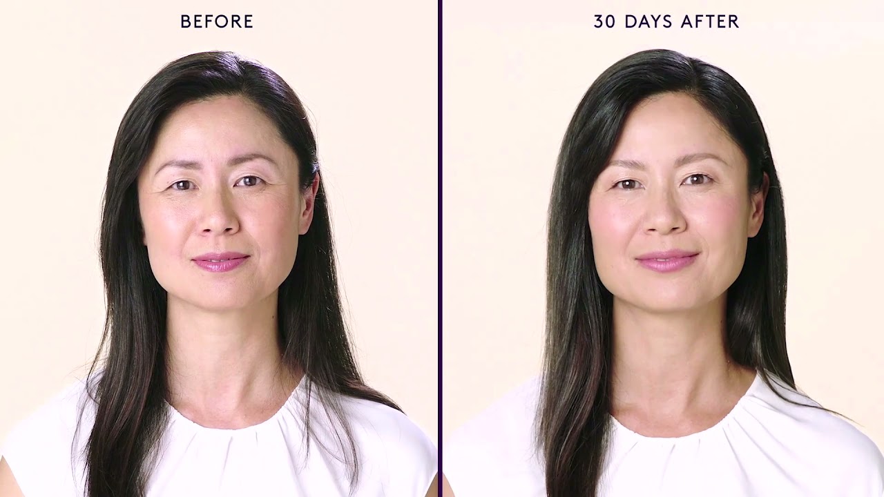 Botox Near Me - Botox Richmond Hill