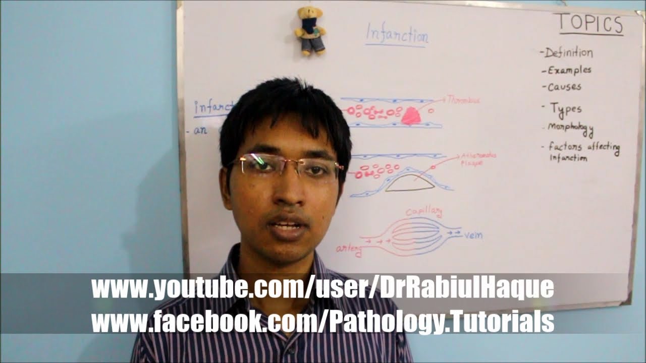 Infarction : Definition, Causes, Types, Morphology, Factors (HD)