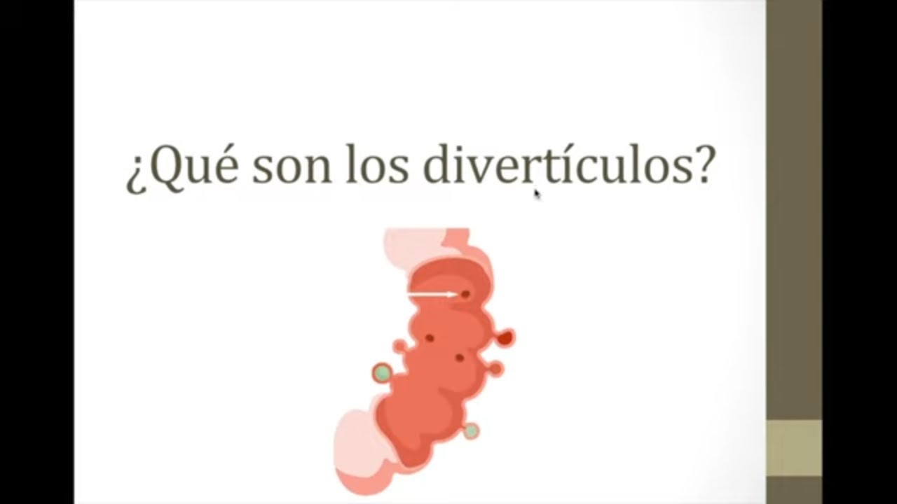 ¿Qué son los divertículos?