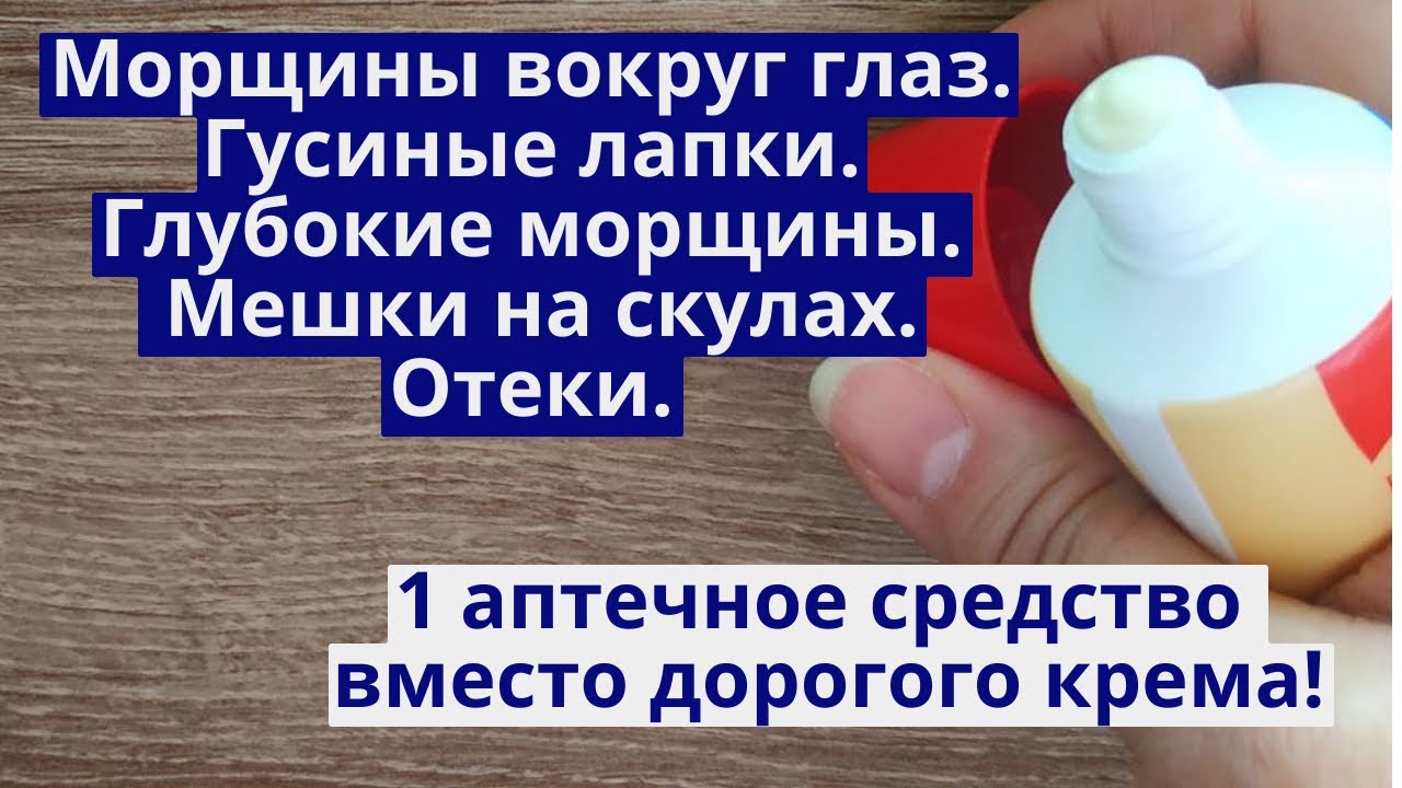 Морщины вокруг глаз. Мешки под глазами. Скуловые мешки. Отеки на лице. ВМЕСТО ДОРОГО КРЕМА!