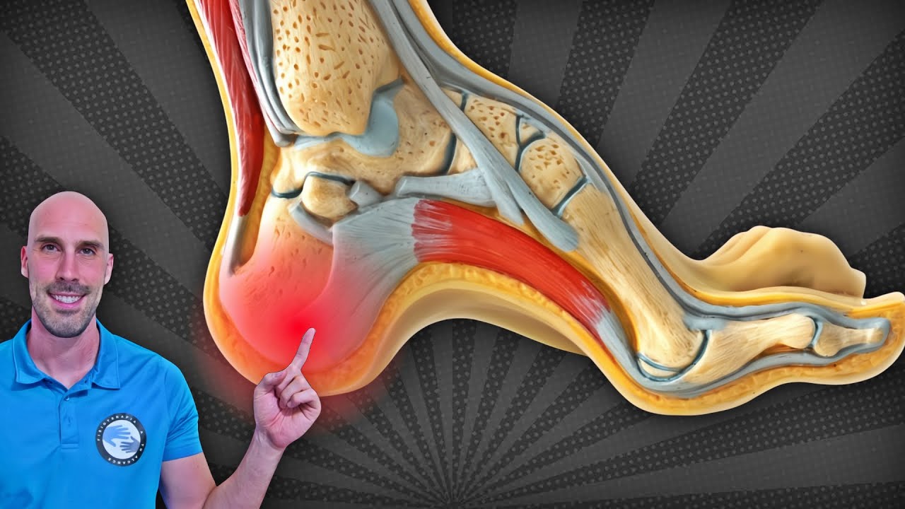 PIE CAVO Y DOLOR DE TALÓN - 3 EJERCICIOS para ALIVIAR la Fascitis Plantar