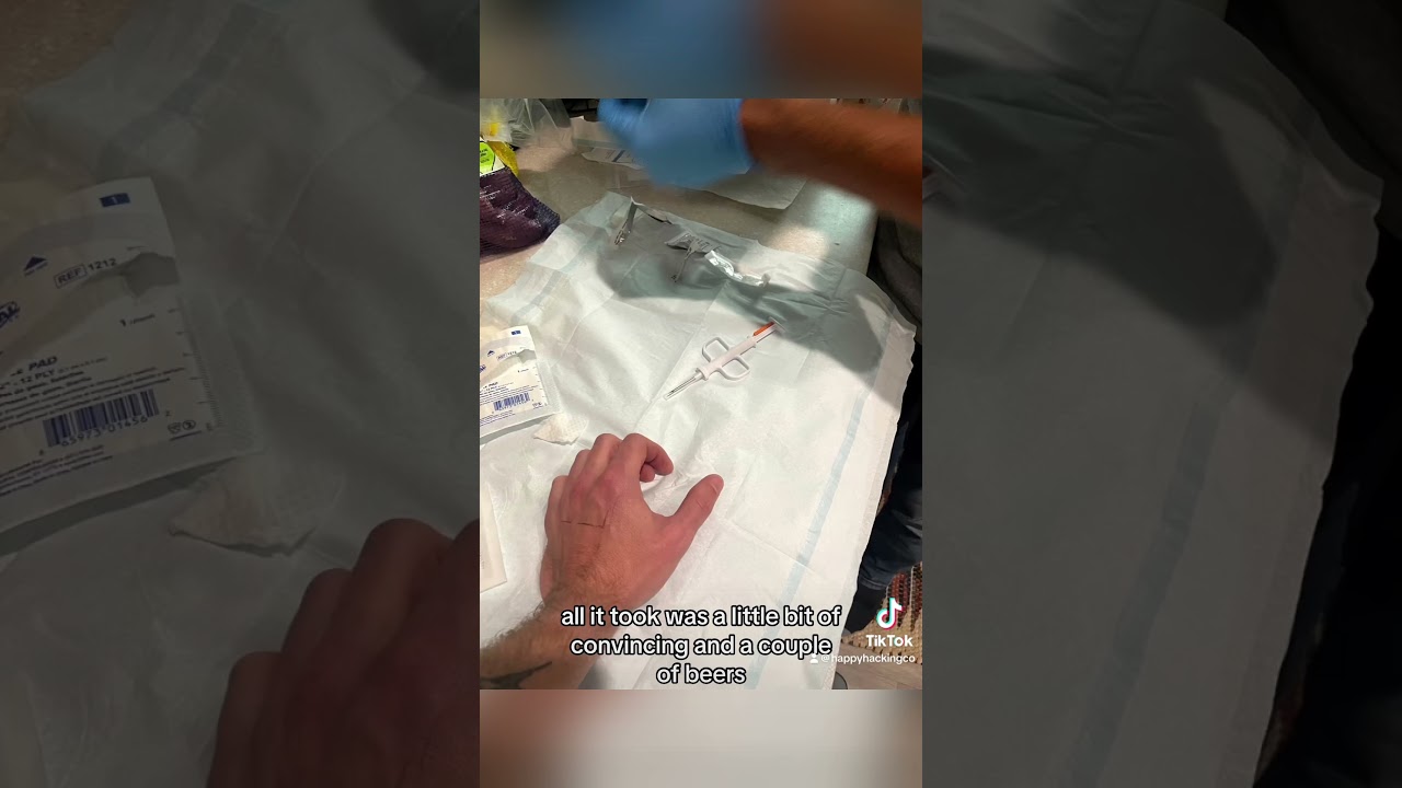 I implanted an RFID chip into my hand?!?