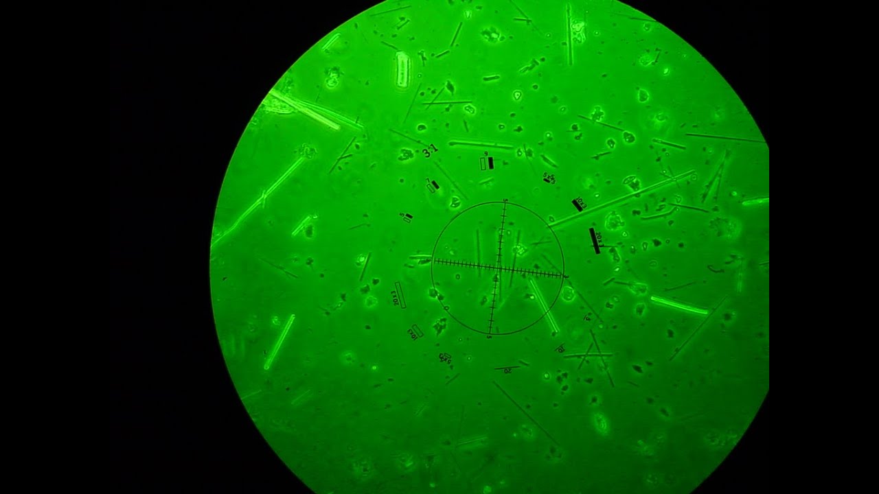 Asbestos Air Sampling Part 6:  NIOSH 7400 microscopy method.