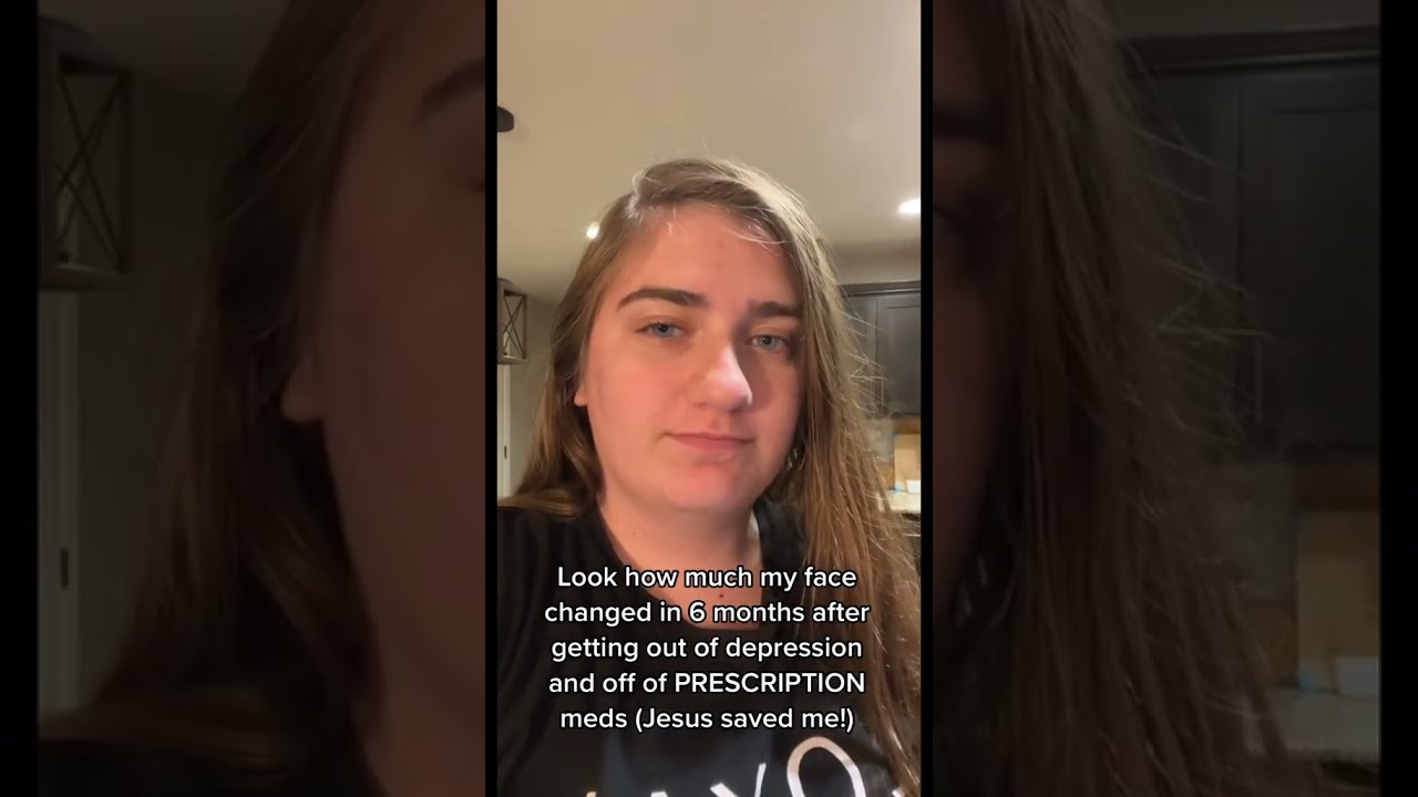 HOW 50 POUNDS WEIGHT LOSS CHANGES YOUR FACE!!
