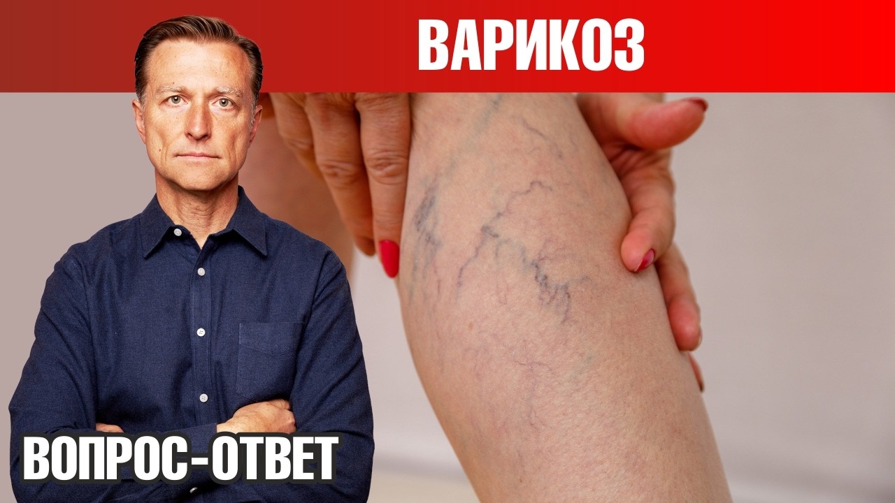 Как избавиться от варикоза 👉 лучший способ и профилактика