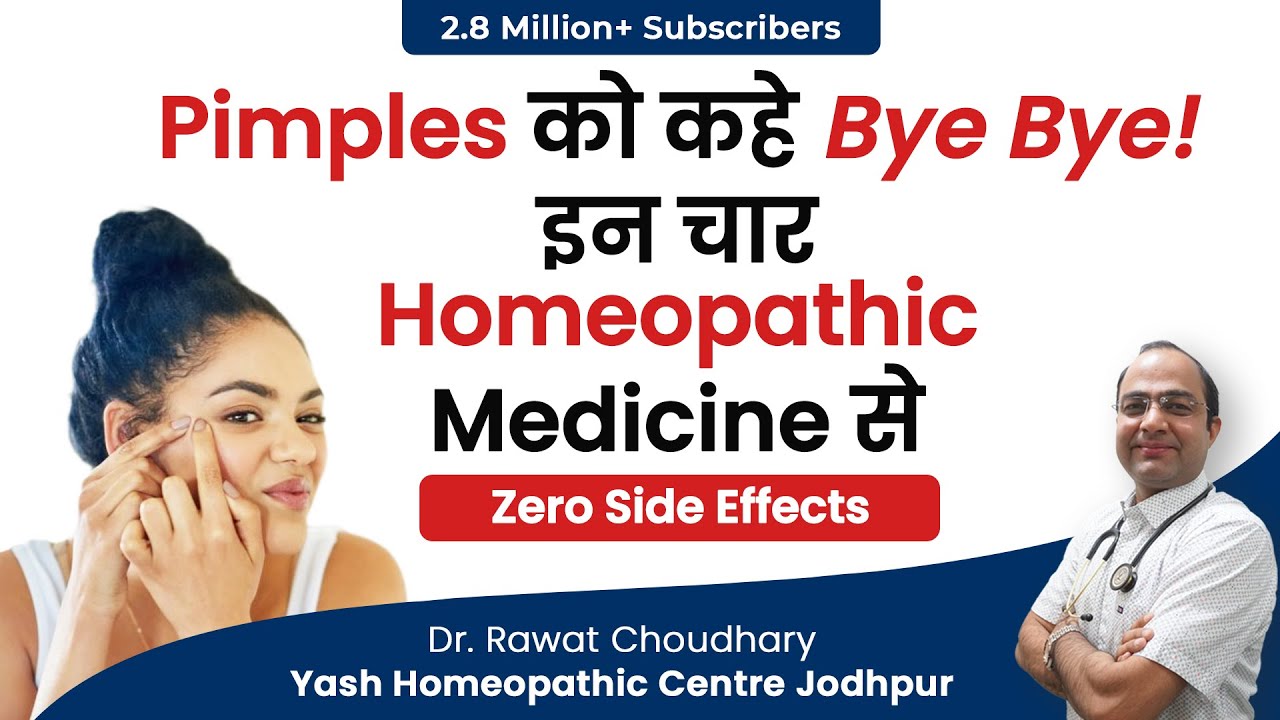 इस दवाई से मुहासे होंगे पूरी तरह ख़त्म | Best Homeopathic Medicine for Acne & Pimple | Acne Treatment