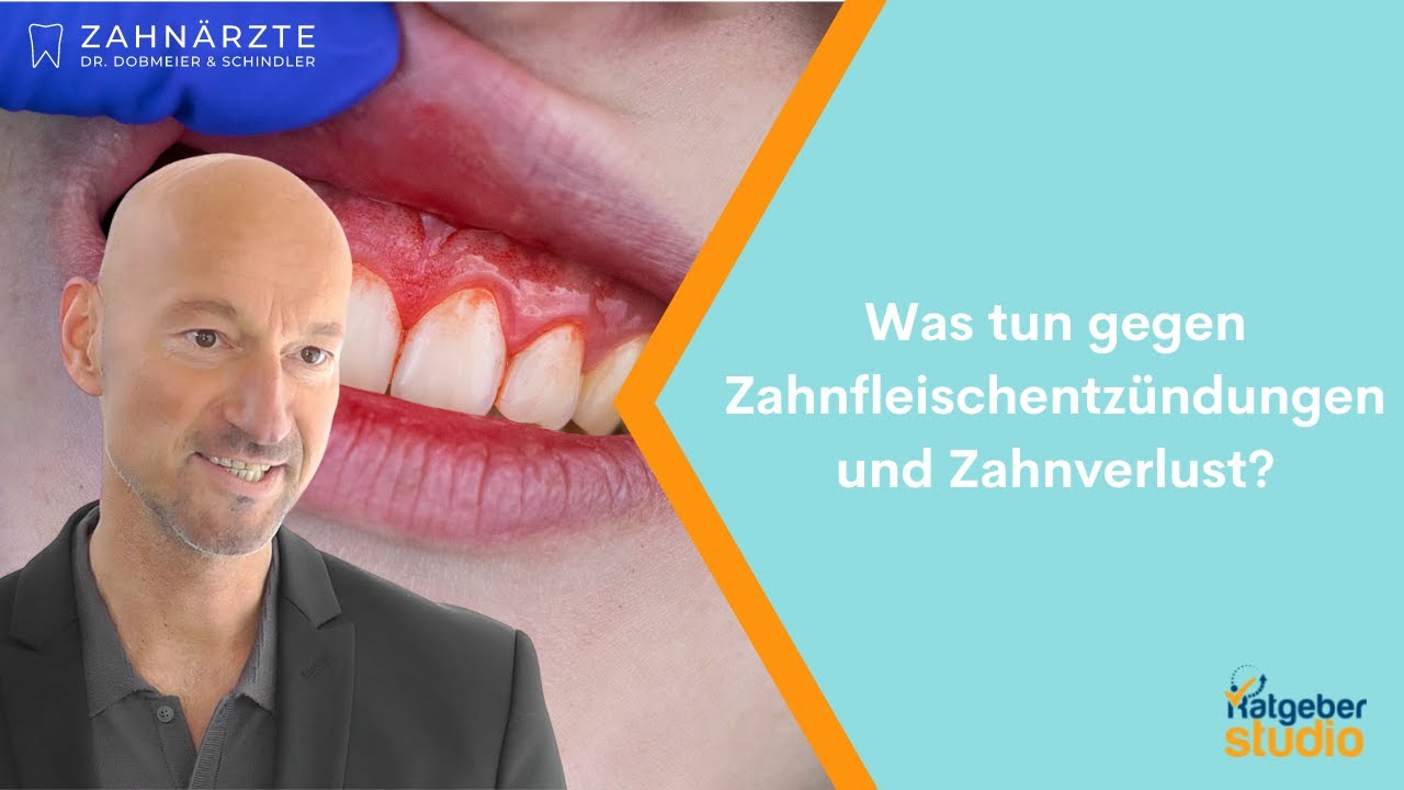 Was tun gegen Zahnfleischentzündung? Damit entzündetes Zahnfleisch nicht zu Zahnverlust führt.