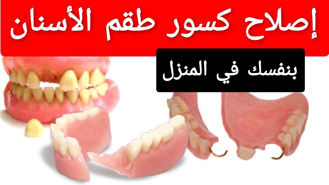 كيفية إصلاح كسور و شروخ طقم الأسنان المتحرك في المنزل و إصلاح وقوع أسنان تركيبات الأسنان المتحركة
