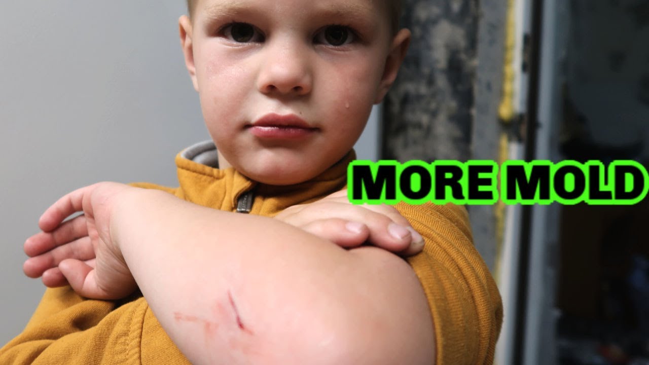 More Mold, More Bike Crashes