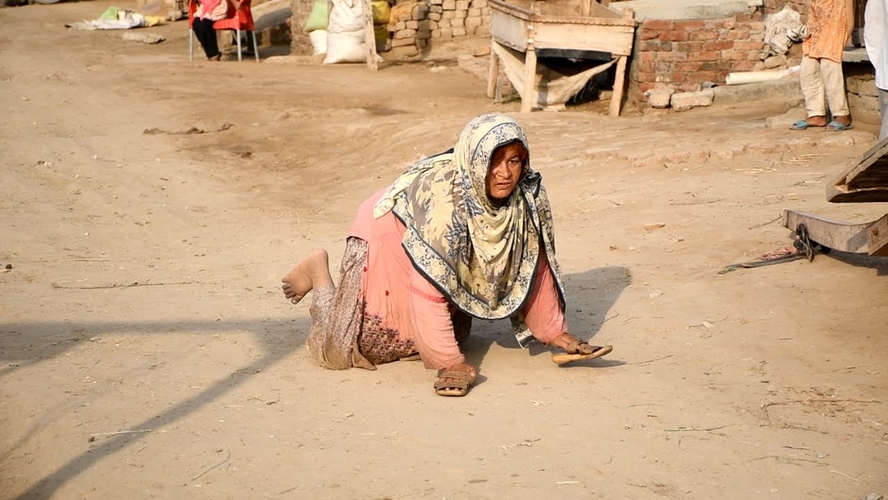 Disable lady move like a little baby. Painful video