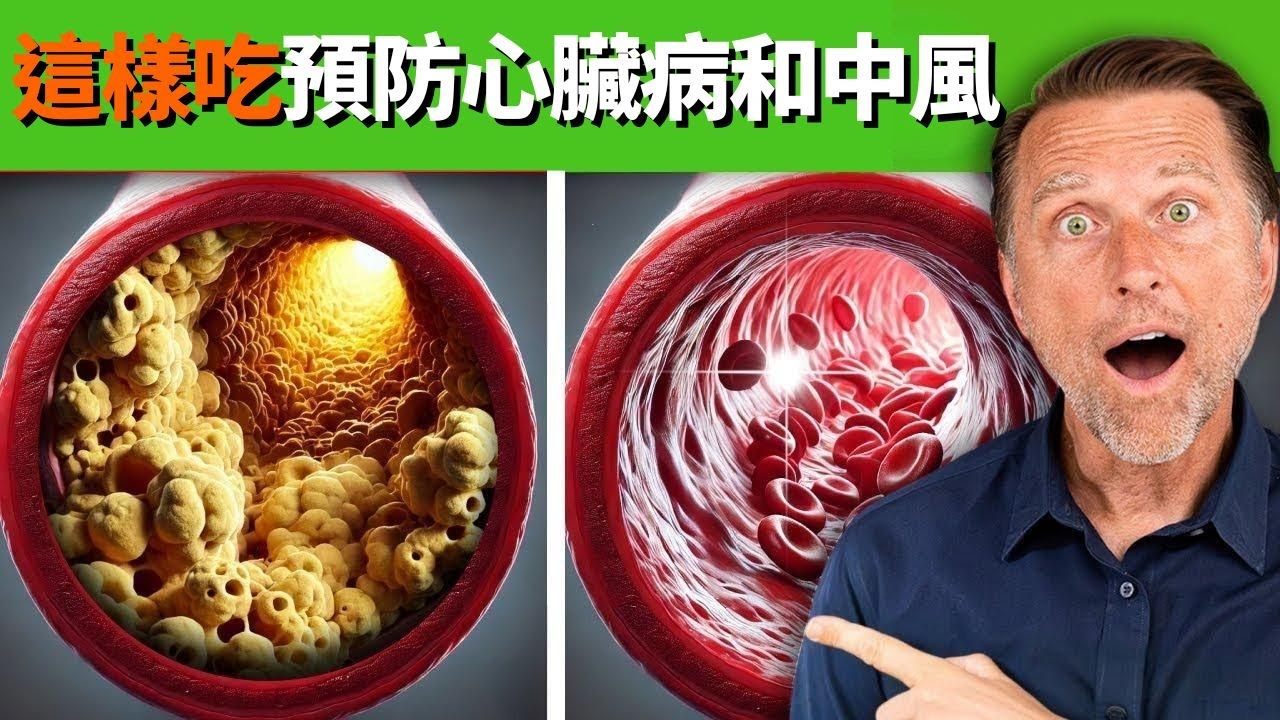 預防心臟病,中風,清血管！柏格醫生 Dr Berg 推薦最佳食物