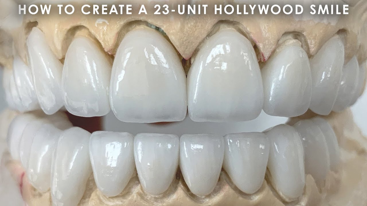 How to create a 23-Unit Hollywood Smile
