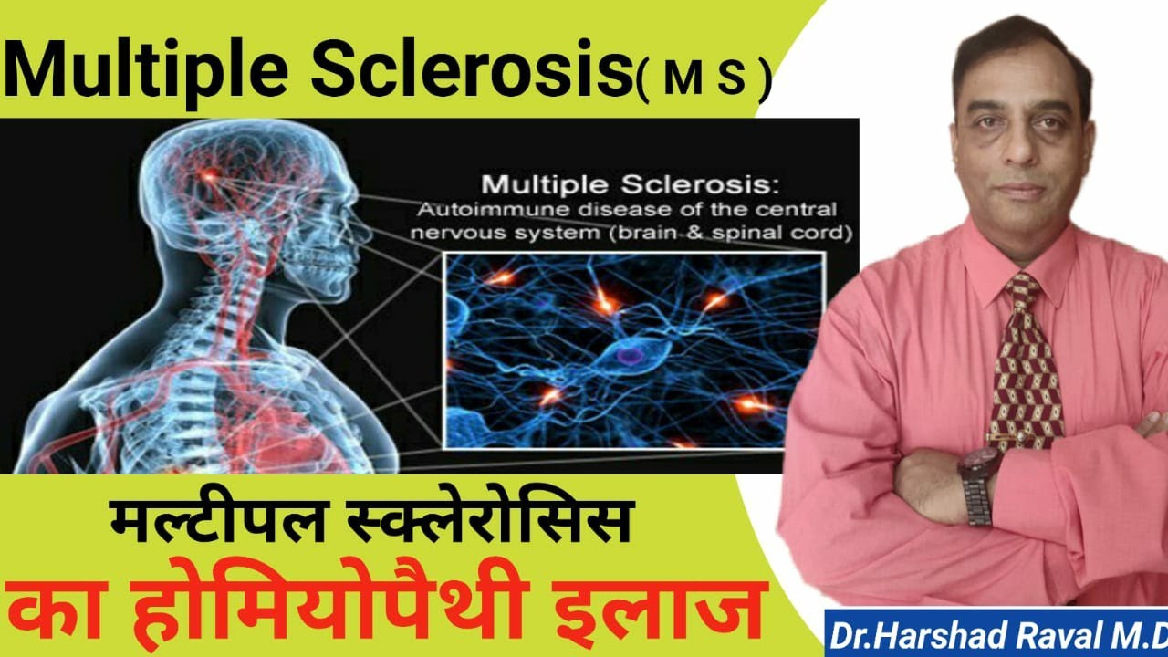 मल्टिपल स्क्लरोसिस क्या है ? Best Homeopathic Treatments For Multiple Sclerosis Explain !