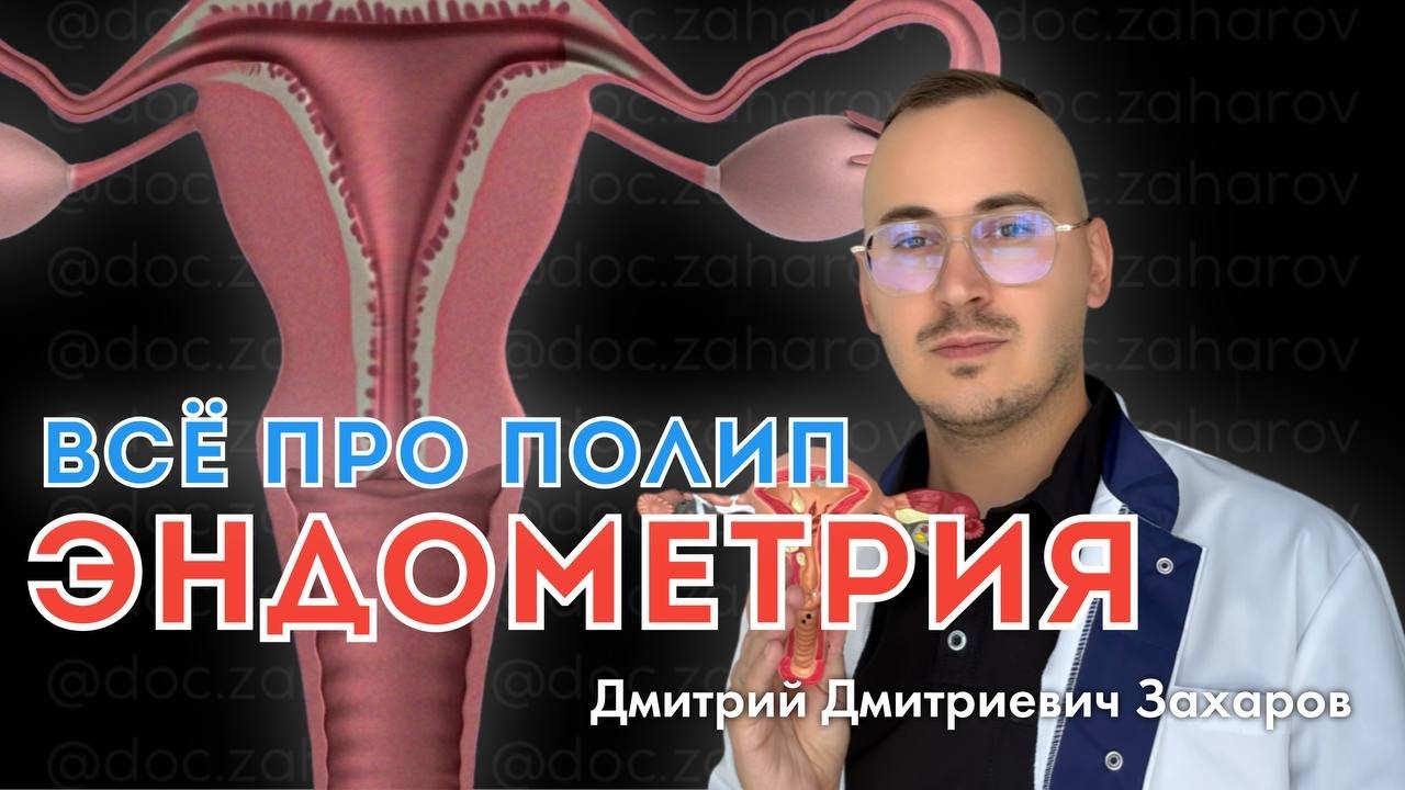 Все про полип эндометрия.