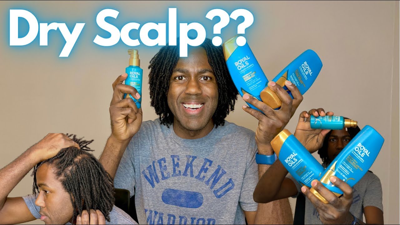DRY SCALP WITH LOCS | GET RID OF DANDRUFF DIY Braidlocs | Royal Oils Line