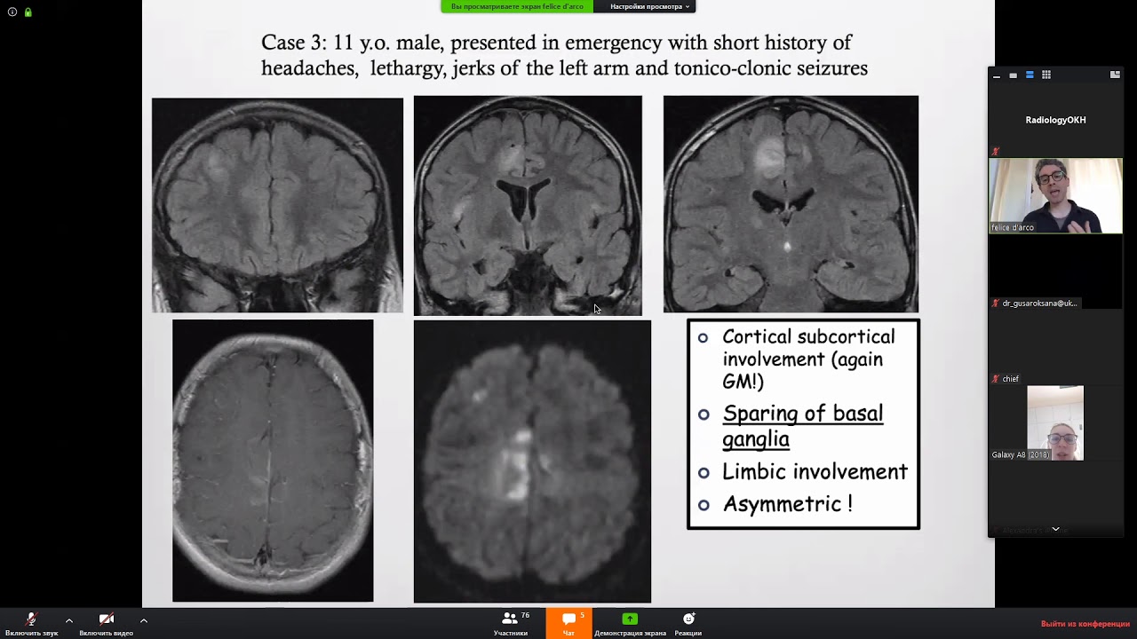 Pediatric Neuroradiology Lectures: Infections and Inflammations of the CNS