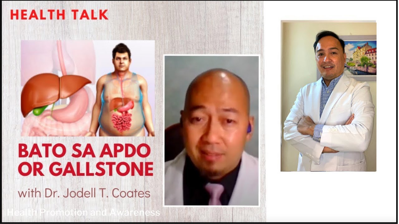 Bato sa Apdo or Gallstone