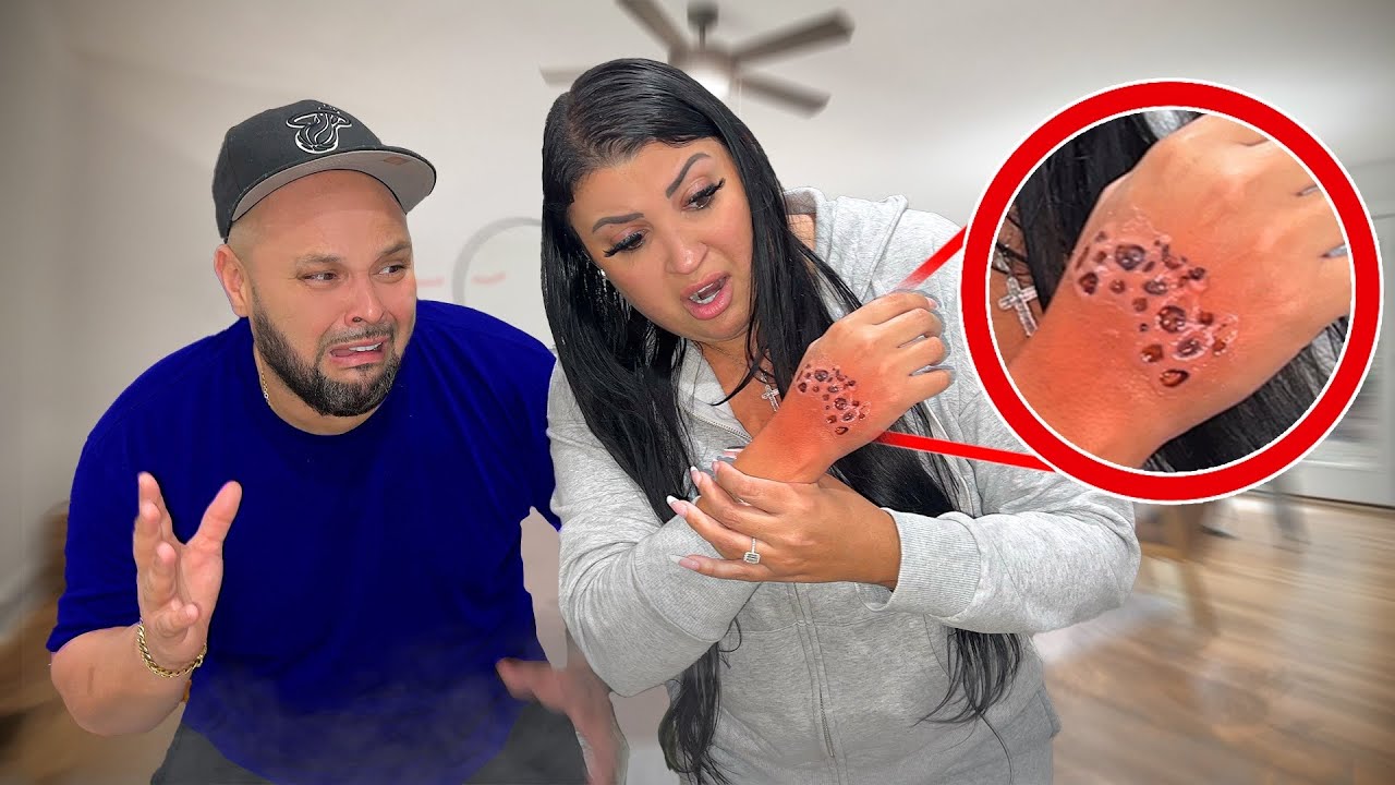 Something ATTACKED Her...
