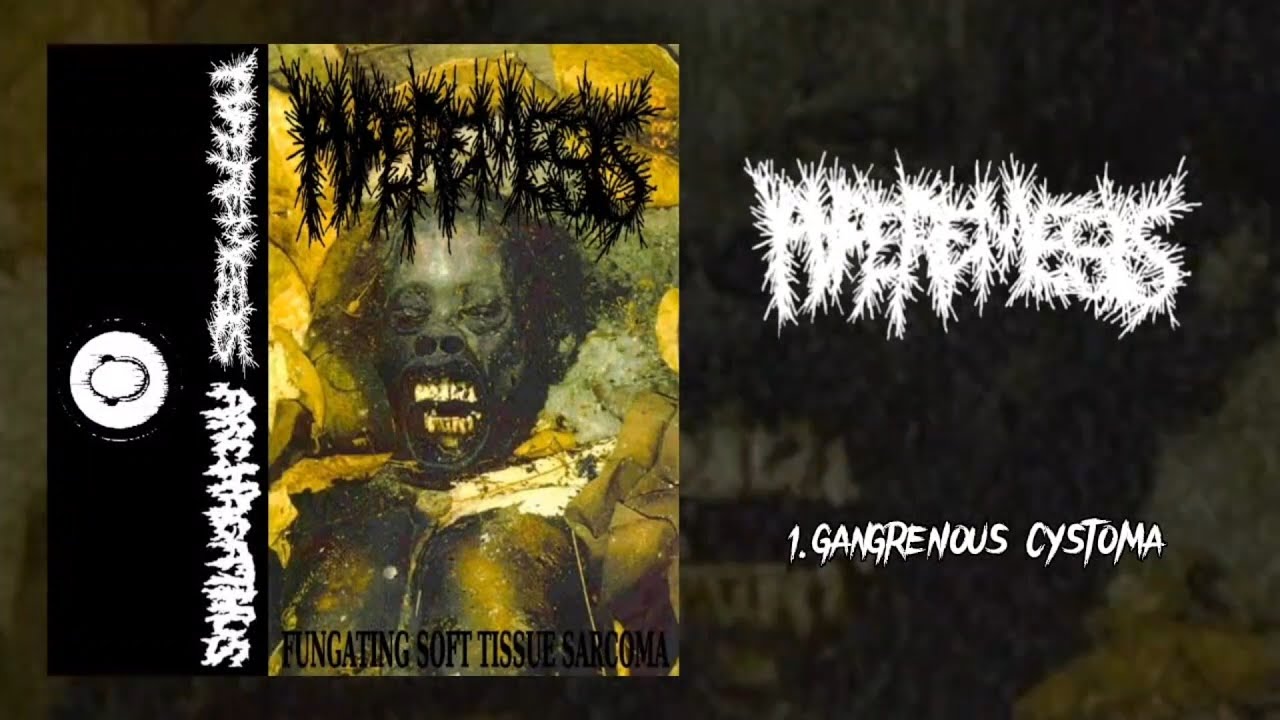Hyperemesis / Archagathus FULL split (2015 Goregrind)