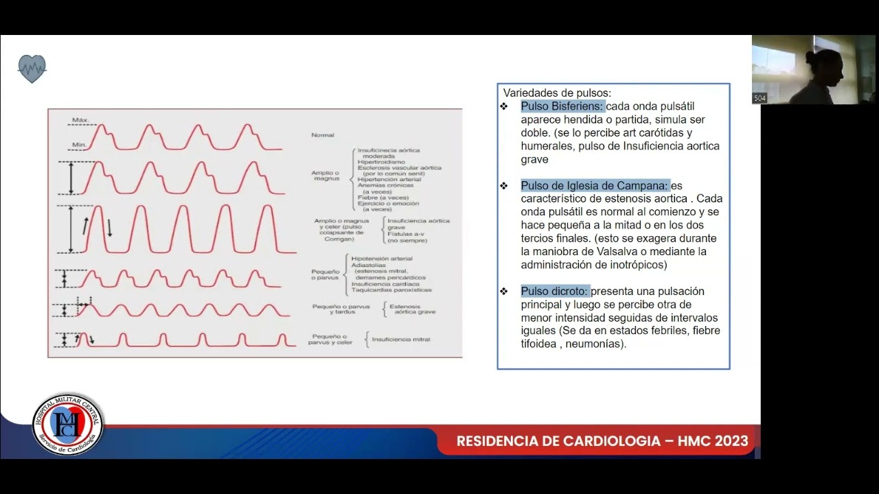 MODULO SEMIOLOGÍA: Pulso arterial
