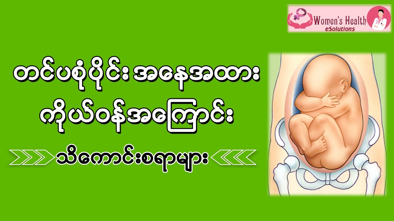 တင်ပစုံပိုင်း အနေအထားကိုယ်ဝန်အကြောင်း သိကောင်းစရာ -  Management of Breech Presentation