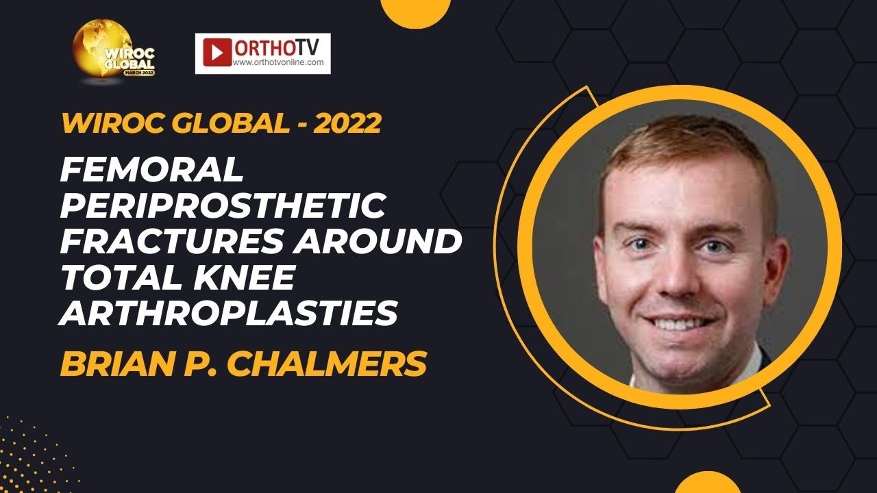 Wiroc Global 2022: Femoral Periprosthetic Fractures in Total Knee Arthroplasties - Brian P. Chalmers