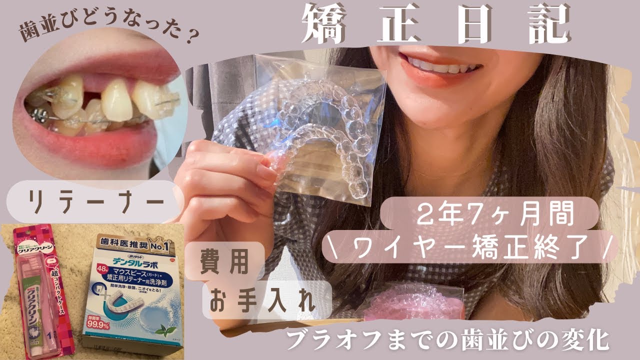 【歯列矯正】ついに‼︎ブラオフ｜変化｜リテーナーの費用・ケアについて