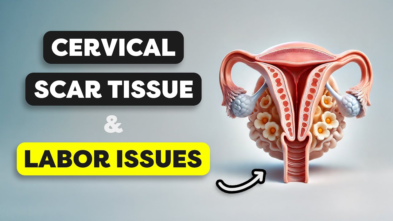 Overcoming Cervical Scar Tissue: Expert Tips for Labor Progress | Moments with MamasteFit