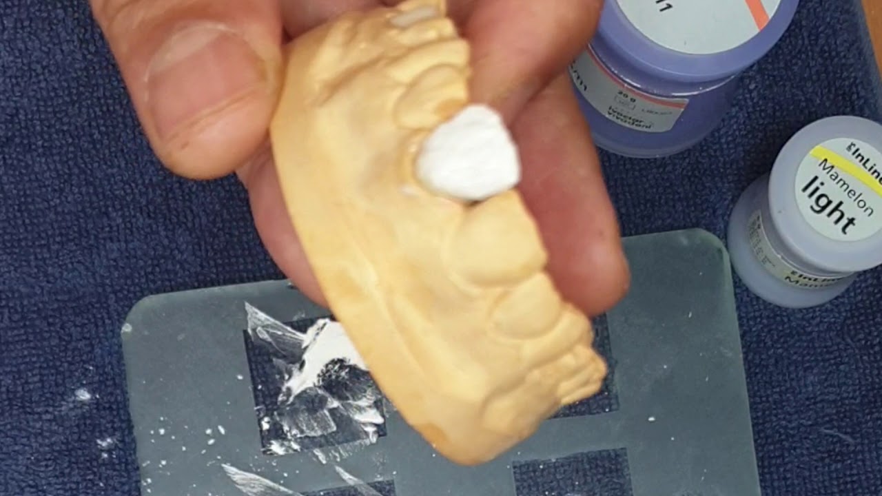 Montage en céramique de la 21   IPS Inline