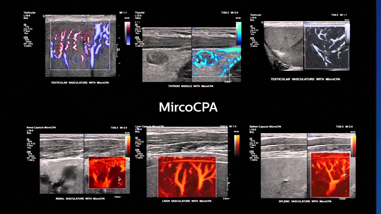 Ultrasound EPIQ new  era in Ultrasound, Intelligence , Performance and Design