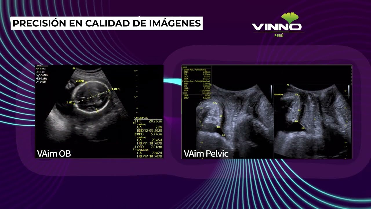 VINNO S300 - VINNO PERU