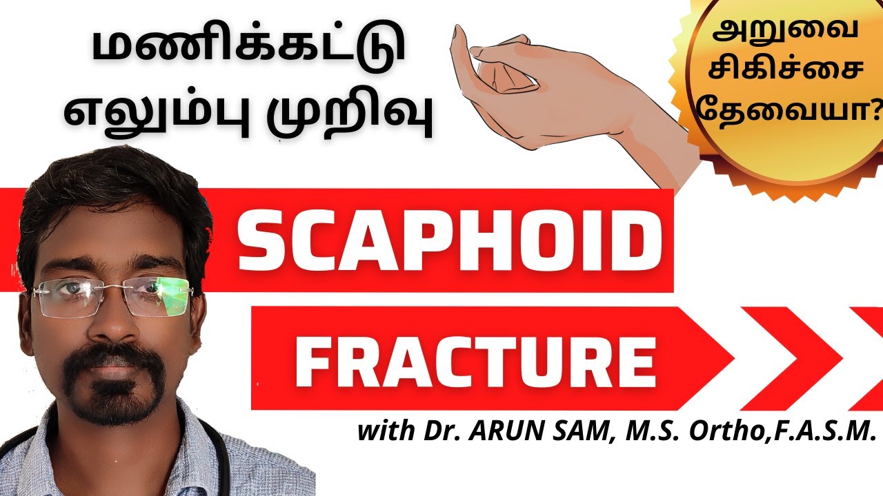 மணிக்கட்டு ஸ்கேபாய்டு எலும்பு முறிவு- அறுவை சிகிச்சை தேவையா? SCAPHOID FRACTURE/ Wrist fracture TAMIL