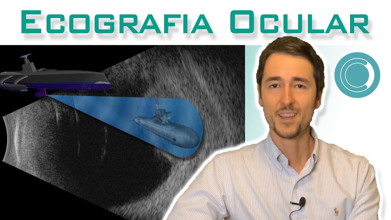 Exame de ecografia ocular | Canal Retina e Vítreo