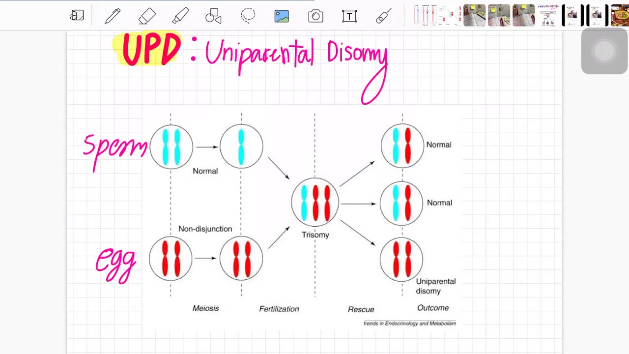Uniparental Disomy-P&rsquo;Nut