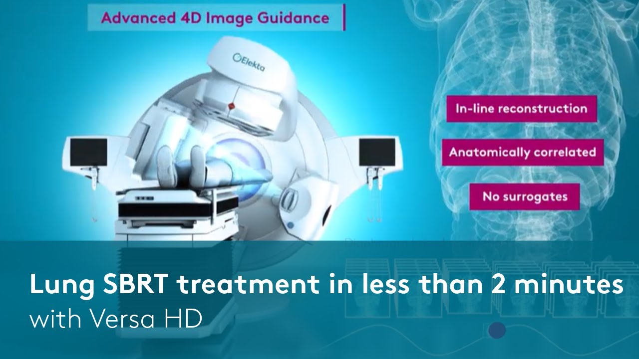 Lung SBRT treatment in less than 2 minutes with Versa HD