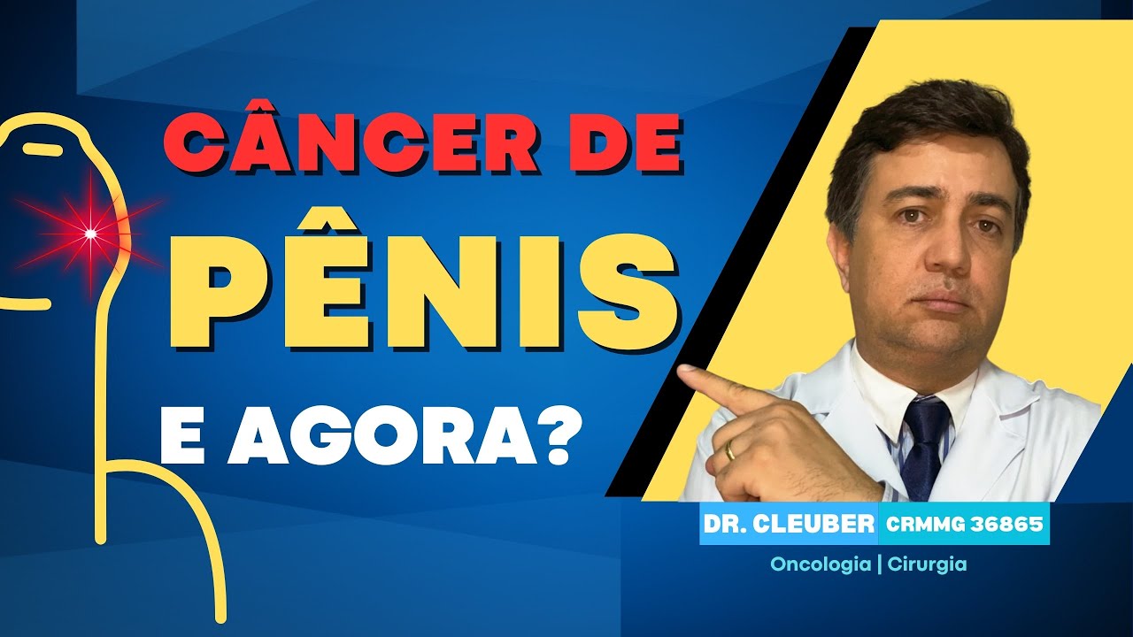 CÂNCER DE PÊNIS: o que Causa, Como Identificar,  e a Vida Após a Cirurgia,@universooncologia