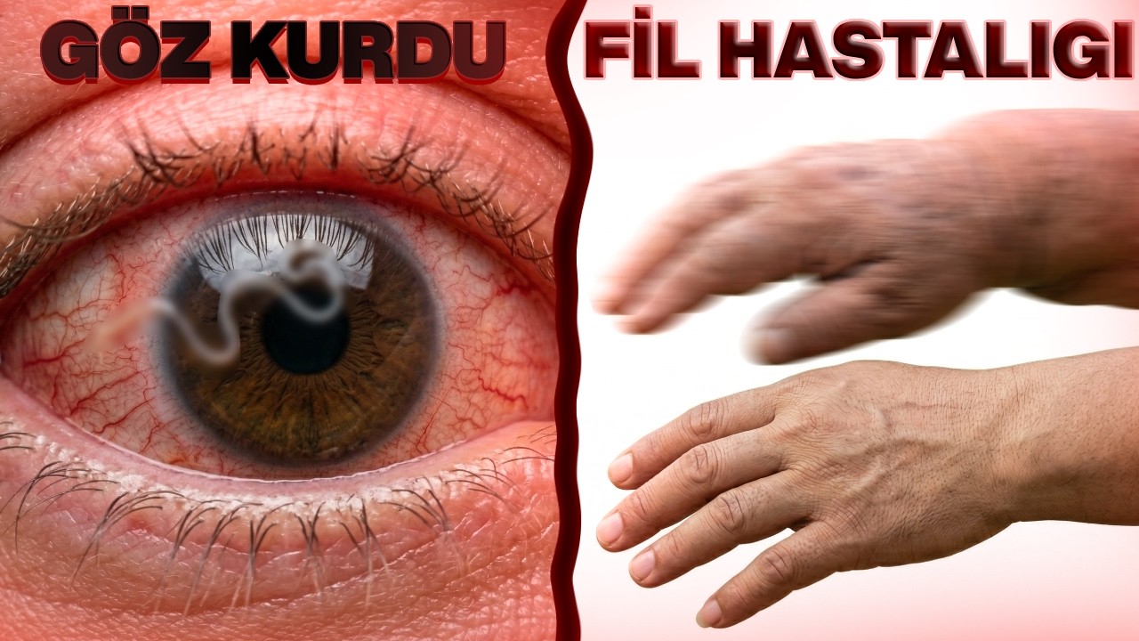Bu &Ouml;*&Uuml;MC&Uuml;L HASTALIKLARA Sahip Olabilirsin...