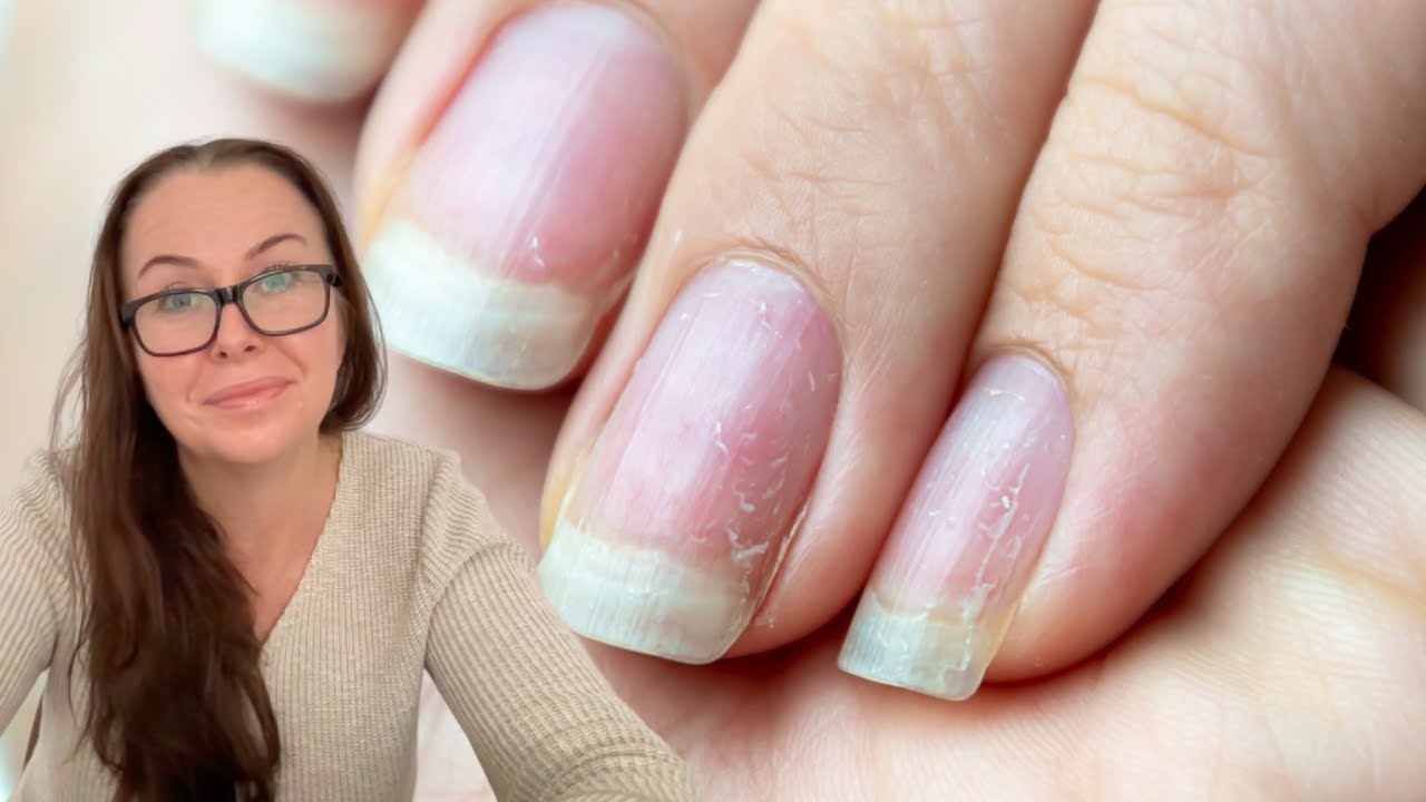 Is it necessary to give nails break from polish? [Nail technician weighs in]