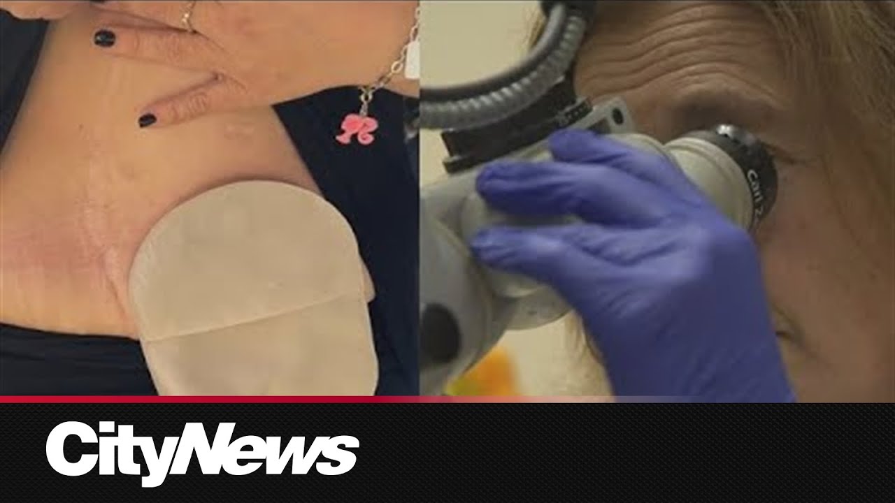 Breaking the stigma: Gynecologic cancer survivor encouraging women to speak up